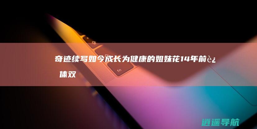 奇迹续写 如今成长为健康的姐妹花 14年前连体双胞胎女婴