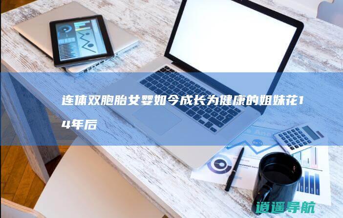 连体双胞胎女婴如今成长为健康的姐妹花 14年后的奇迹